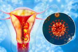 Gynae Cancer Awareness